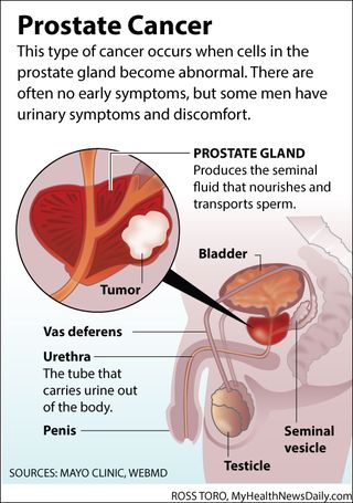 Diagram of the male prostate gland.