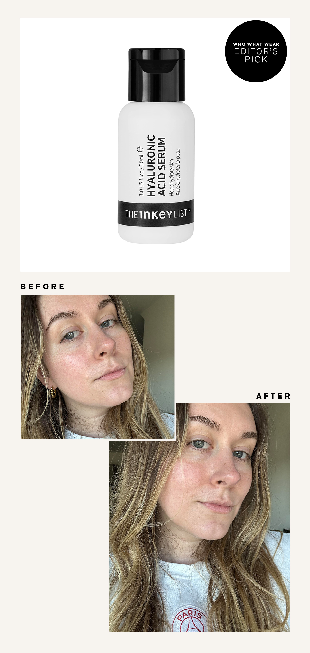 The Inkey List Hyaluronic Acid Serum: Before and After Picture