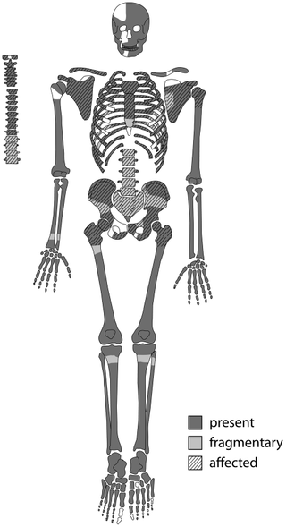 Preserved Skeleton