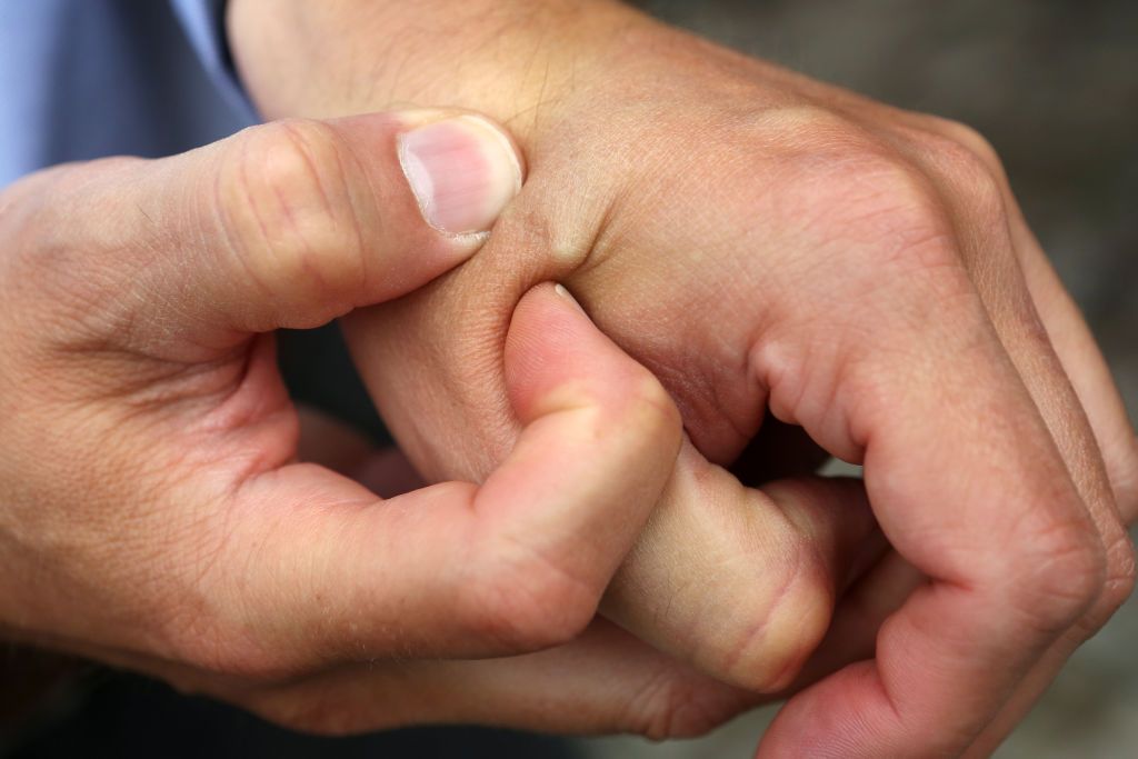 Microchip implant in hand.