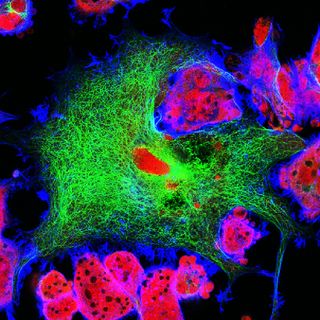 Fluorescence microscopy view of human neuroblastoma cells.