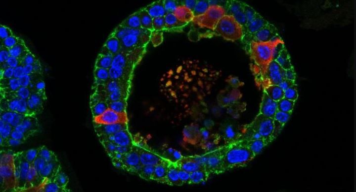 An image shows a tear gland grown from stem cells from a mouse in a petri dish. The researchers also grew human tear glands.