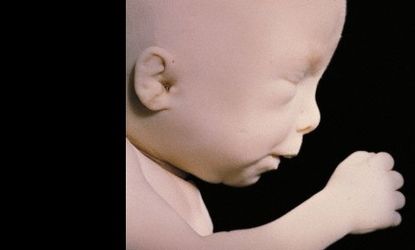 At 20 weeks, this fetus doesn't feel pain, a new study claims.
