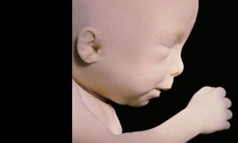 At 20 weeks, this fetus doesn&amp;#039;t feel pain, a new study claims.