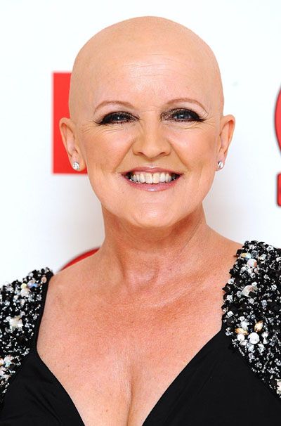 Bernie Nolan goes bald to awards show