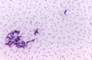 Toxoplasma gondii parasite