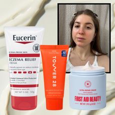 eczema cream
