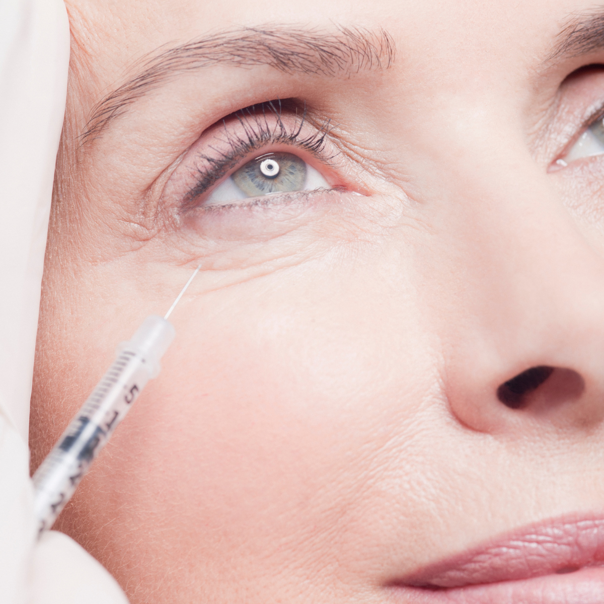 how perimenopause affects aesthetic treatments