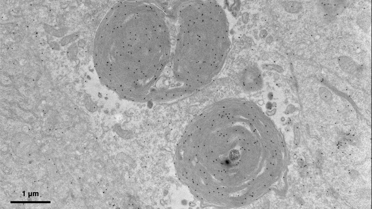 black and white microscopic image shows two swirly oval shapes with black dots speckling their surfaces