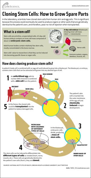 Infographic: How cloning produces stem cells that can be used to create organs or other body parts as needed.