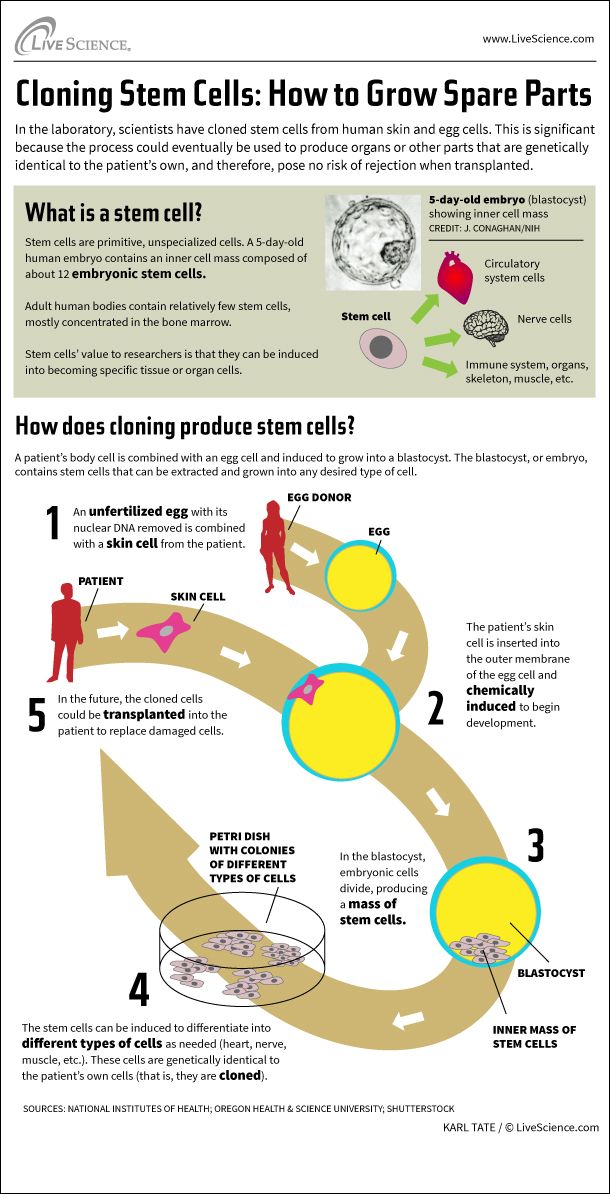 Infographic: How cloning produces stem cells that can be used to create organs or other body parts as needed.