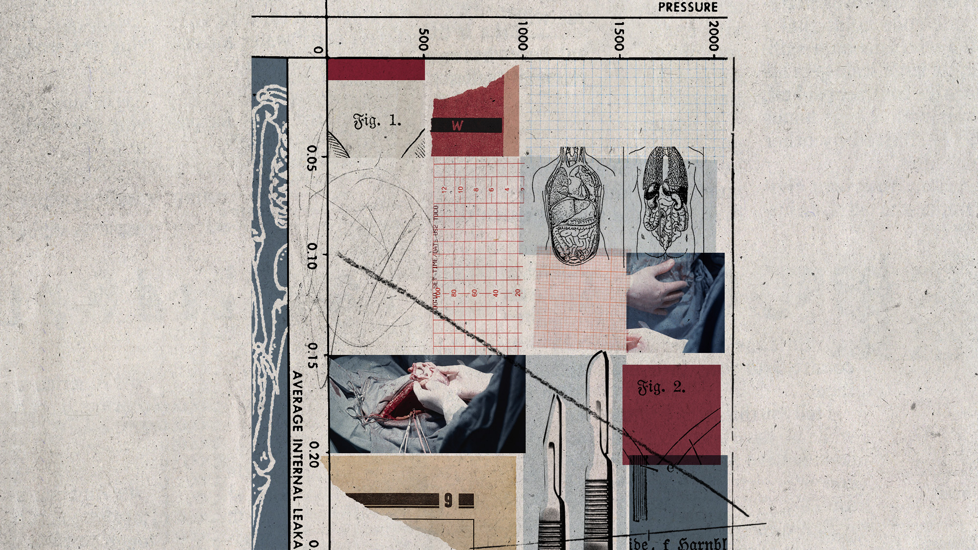 Photo collage of scalpels, medical imagery and a vintage surgery photograph in a grid 