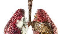 Anti-vaping poster showing rotten strawberries as lungs