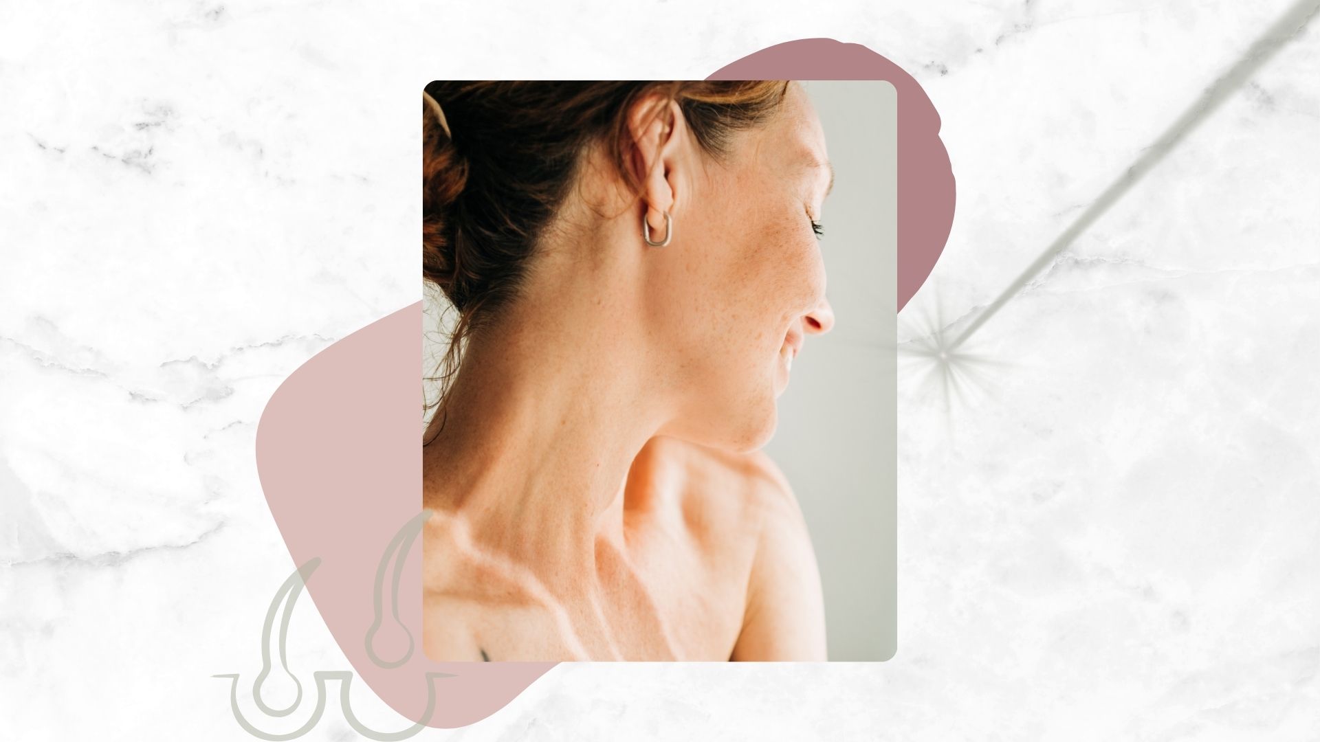 A marble backdrop with an image of a woman's cheek facing away and a green illustration of a hair in the follicle