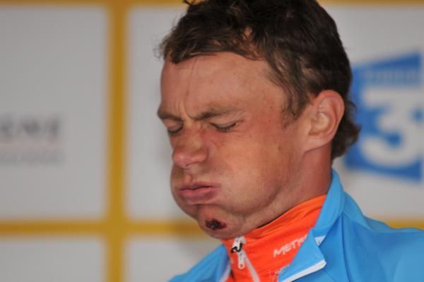 Benoit Daeninck (Roubaix Lille Metropole) showing the effects of a crash