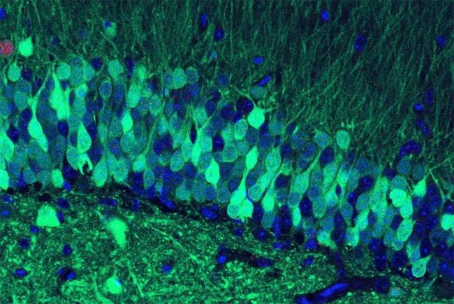 How does the brain store memories? | Live Science