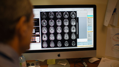 Scientists examine a brain scan in a hospital
