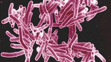 Mycobacterium tuberculosis bacteria, which causes TB