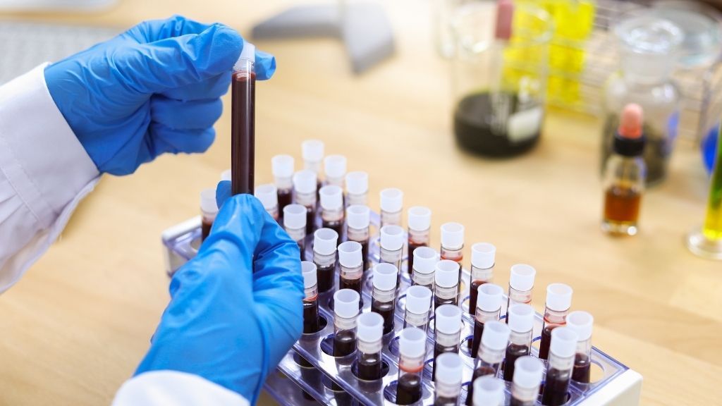 Gloved hands pick up a vial of blood from a tray of blood samples