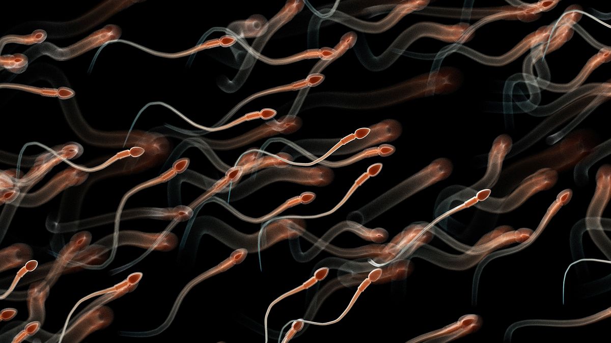 an illustration of many human sperm cells swimming from the lower left to upper right corner against a black background