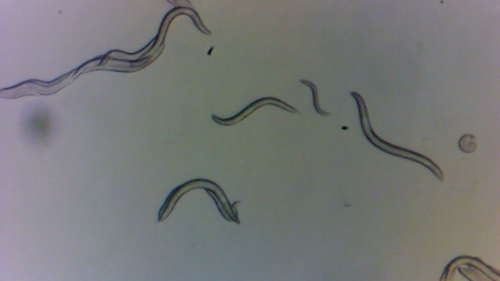 Worms as seen under a microscope 