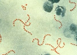 Streptococcus pyogenes 