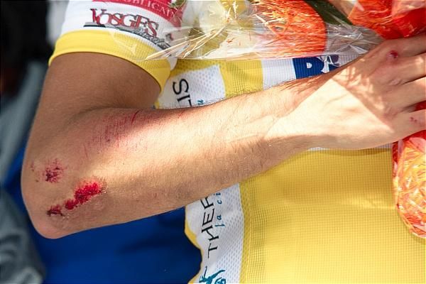 Nacer Bouhanni (FDJ-BigMat) crashed late in stage 2, but recovered to finish third on the stage and defend his leader's jersey.