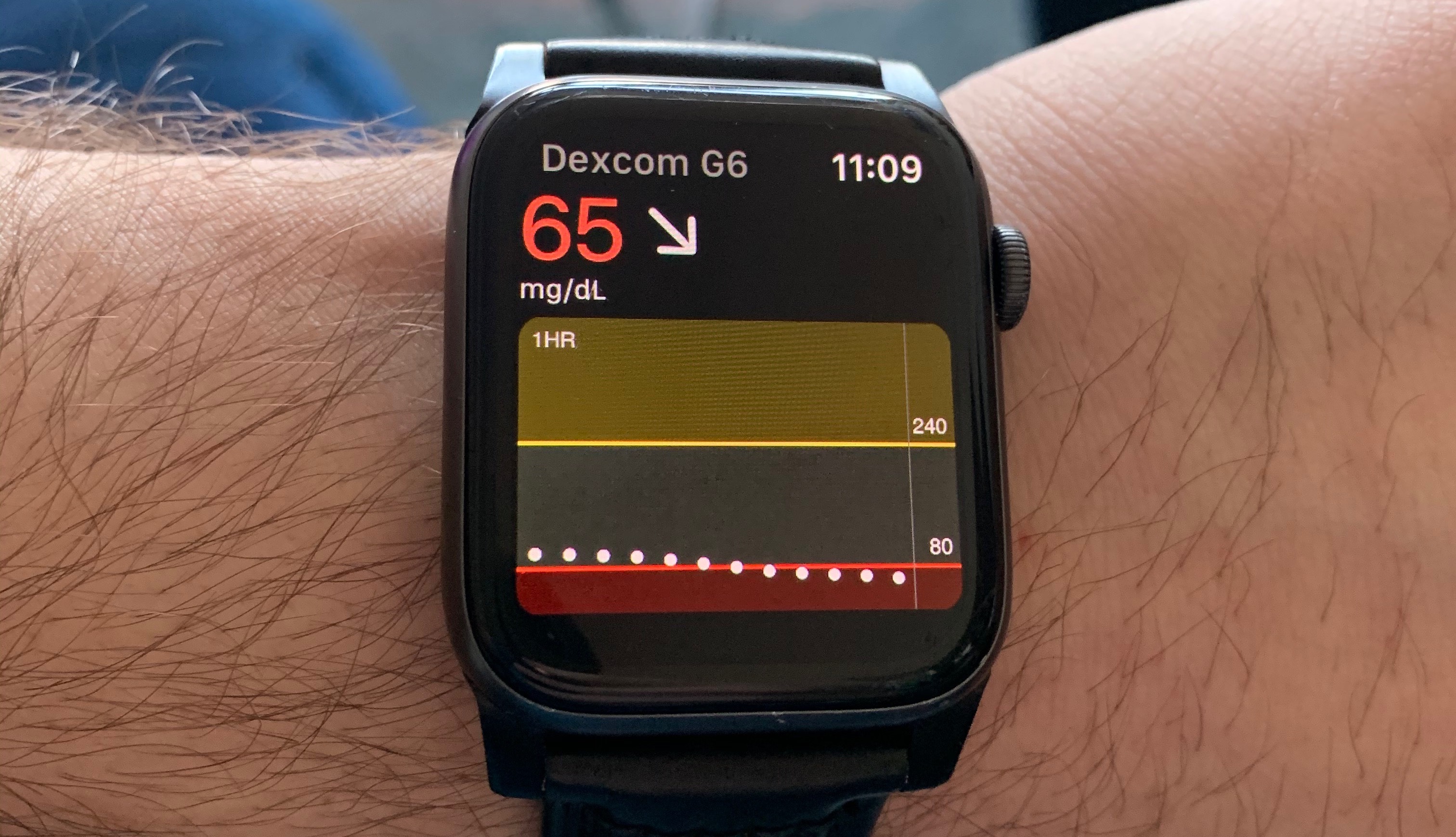 Help me, Tom’s Guide I need an Apple Watch to monitor my diabetes