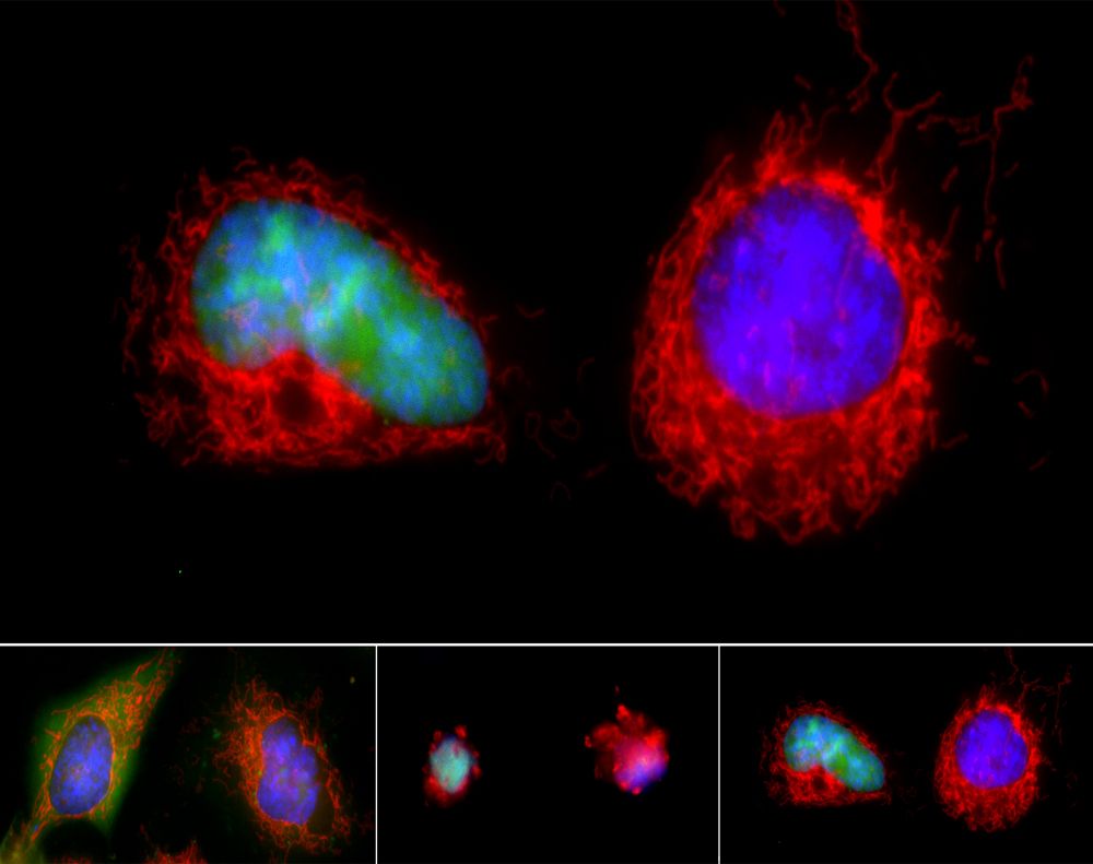 nsf, national science foundation, research in action, ria, apoptosis, medical research, NIH, NSF, cells, cell, cancer, disease, DNA, organelles, cellular suicide, proteases, proteins, apoptotic trigger, anastasis, Johns Hopkins, genes, DNA