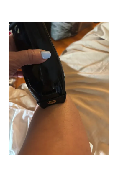 Domenica F., a 'Marie Claire' tester, tests the SmoothSkin Pure IPL Hair Removal Device