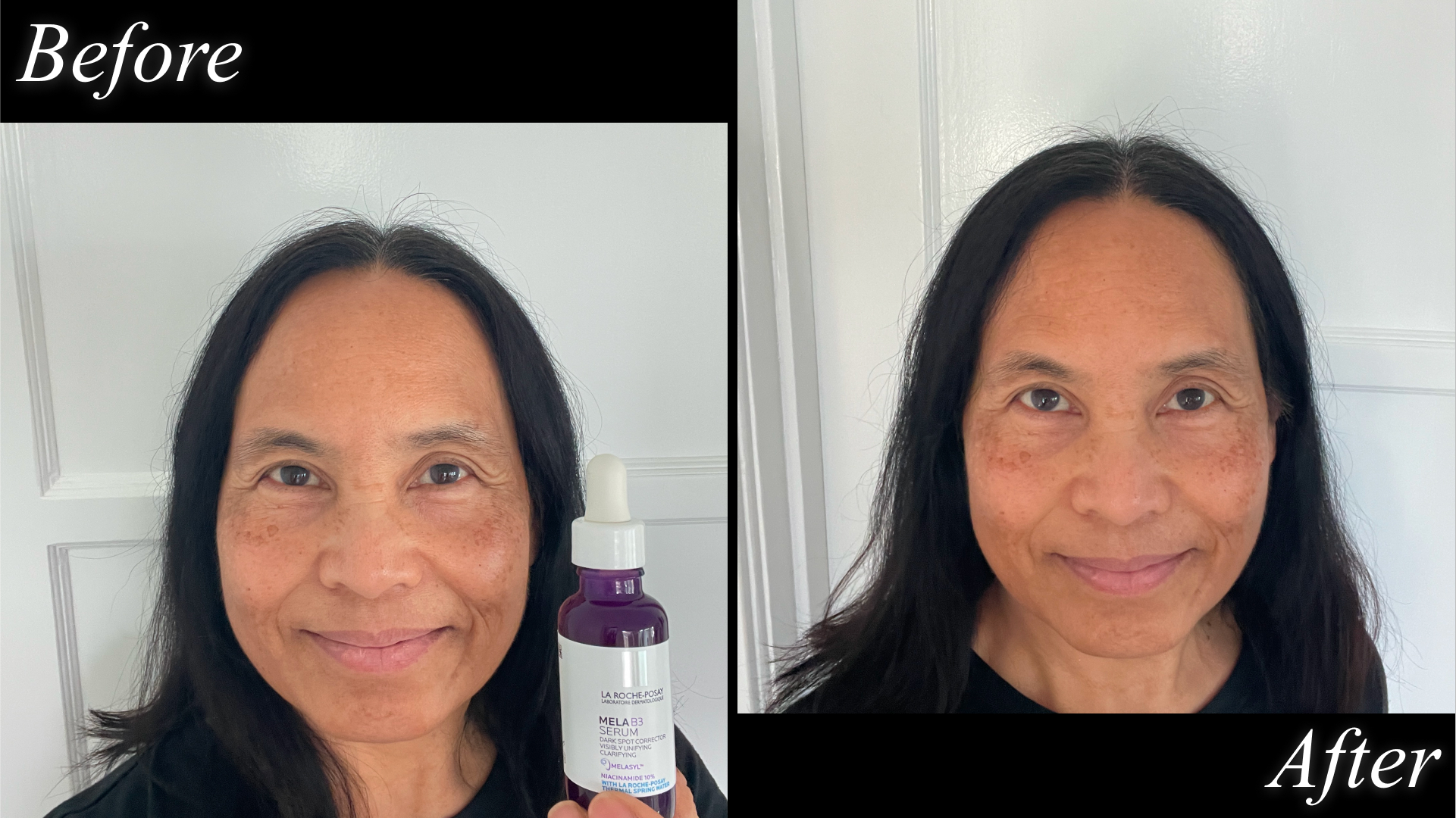 Ann Malzahn Testing La Roche Posay dark spot corrector