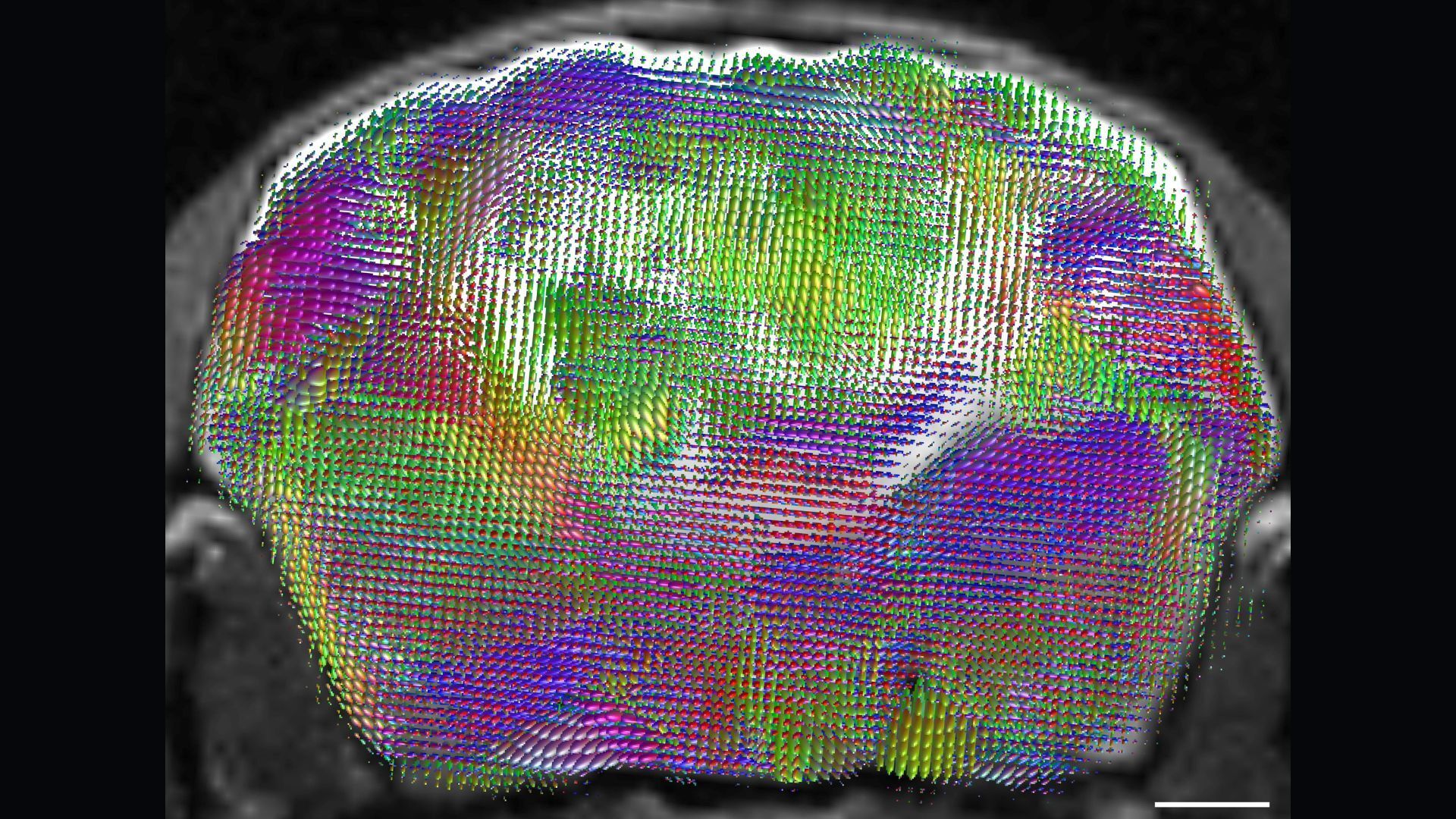 Another view of a mouse's brain with nerve fibers labeled in bright colors