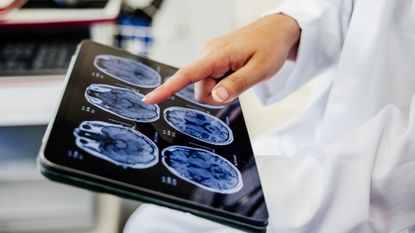 A person wearing a white lab coat points to a series of blue brain scans on a tablet