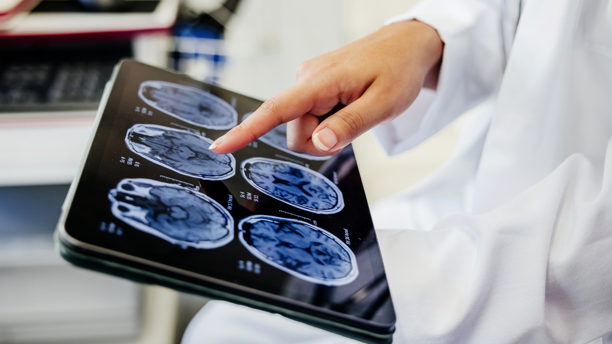 A person wearing a white lab coat points to a series of blue brain scans on a tablet