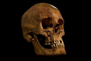 Richard III's skull