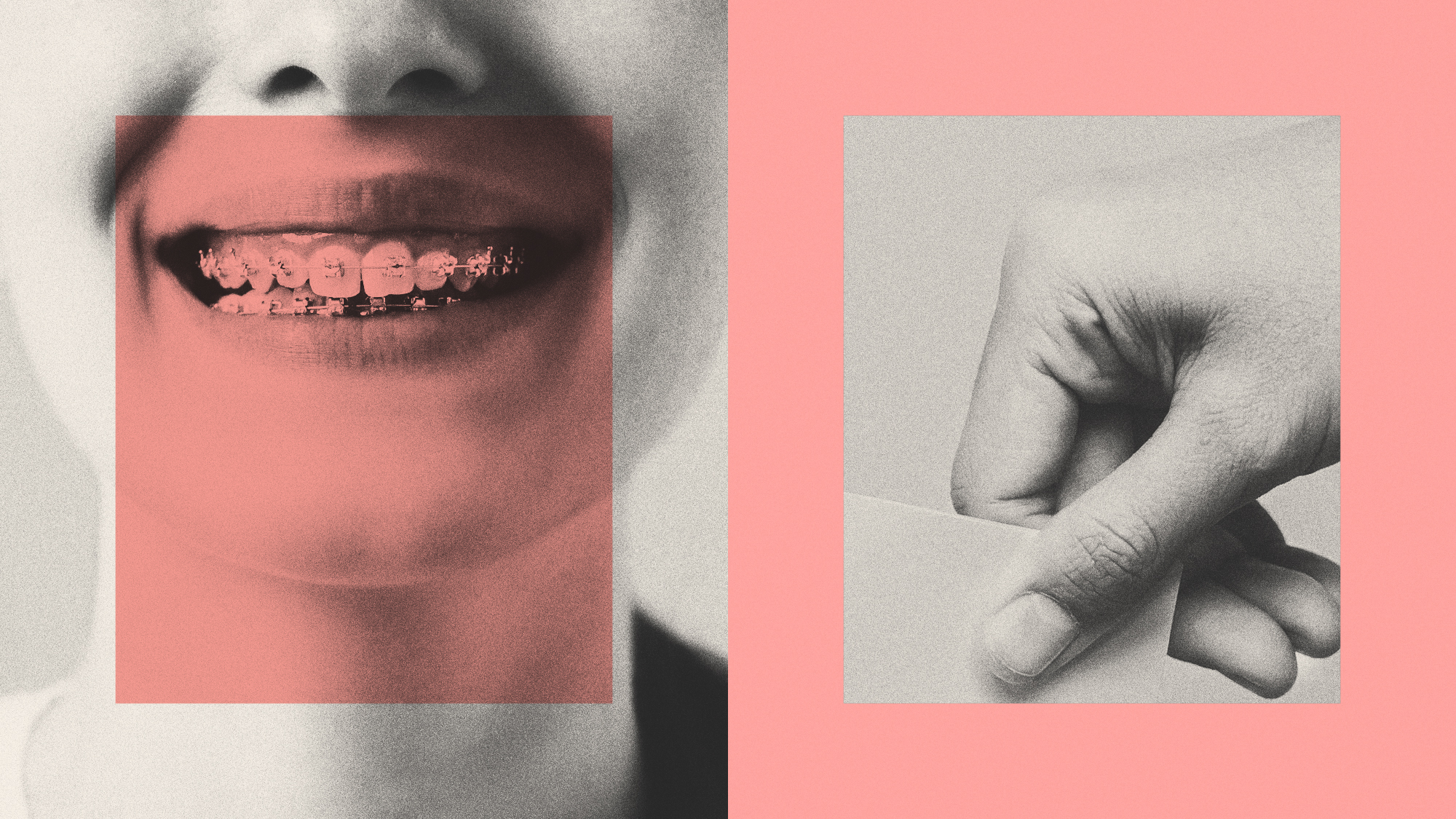 Photo composite illustration of a close up of a teenager's dental braces and a hand casting a ballot