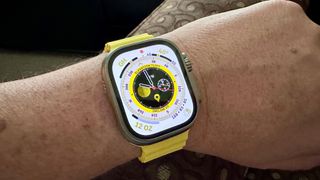 Apple watch online danger