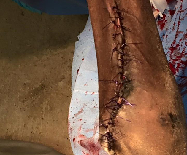 fifthleg1