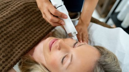 woman getting laser treatment for acne scar