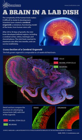 Scientists can now grow functional mini brains for study. [See full infographic]