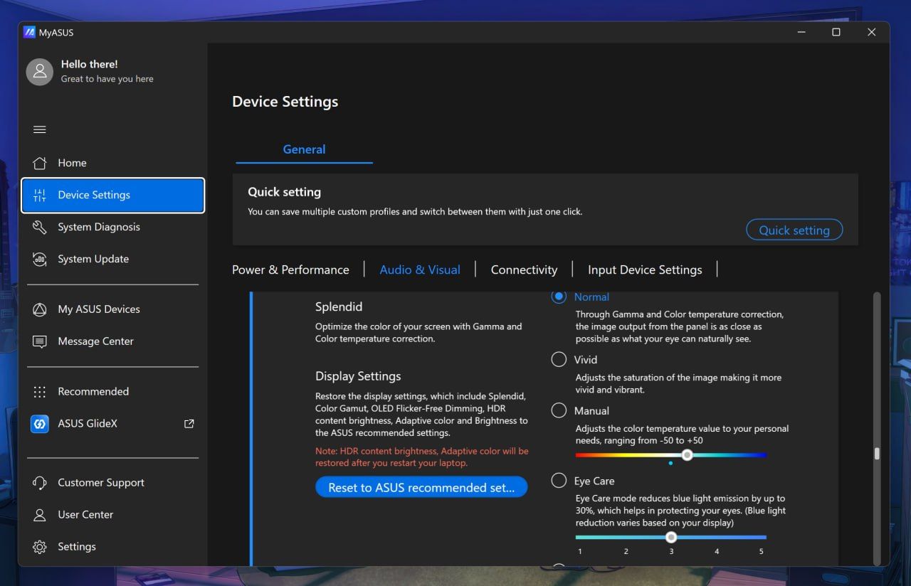 MyASUS Device Settings under Audio & Visual, showing Splendid color optimization modes including Normal, Vivid, Manual, and Eye Care.
