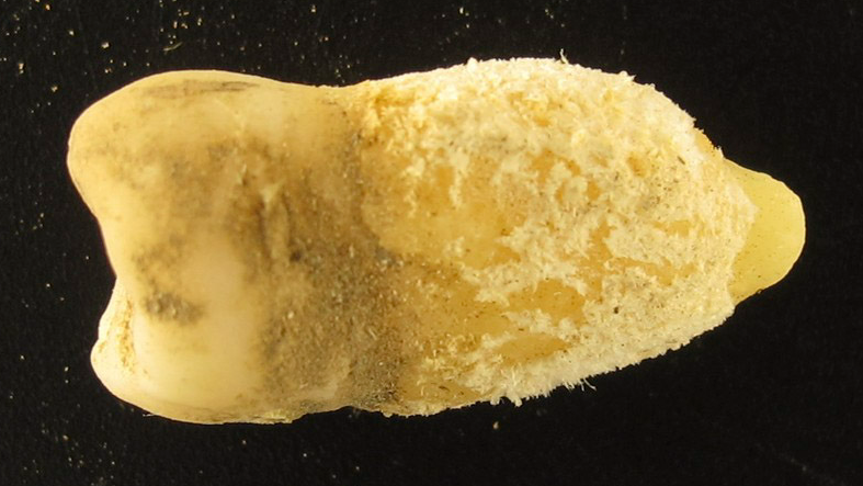 a human premolar tooth against a black background