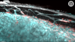 Researchers discovered a previously unknown network of capillaries called trans-cortical vessels (lines extending outward in the photo) in mouse bones. 