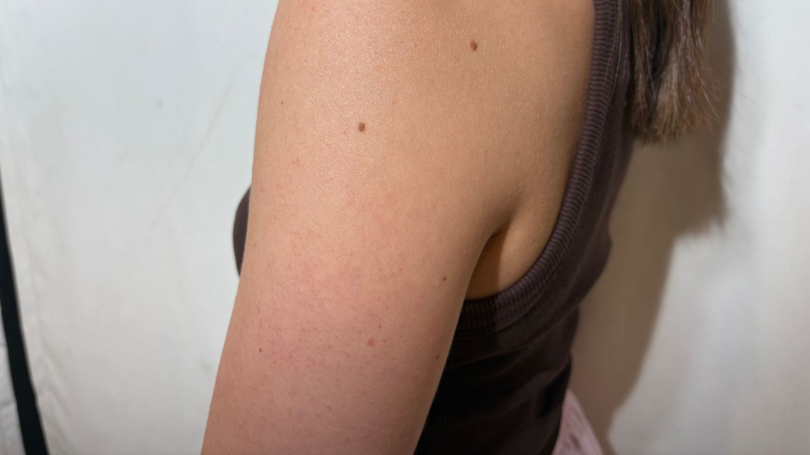 Jess' arm after using Mixa Urea Cica Repair Renewing Cream