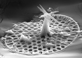 SEM of spiny microfossil