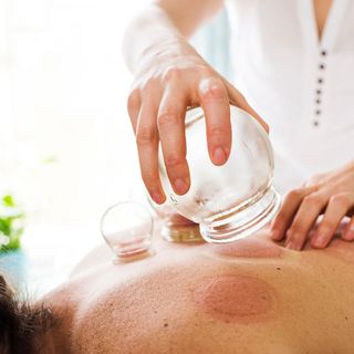 what-is-cupping-therapy-259596-1528110698780-main