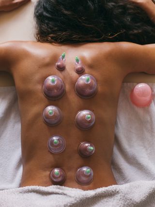 what-is-cupping-therapy-259596-1605232218362-main