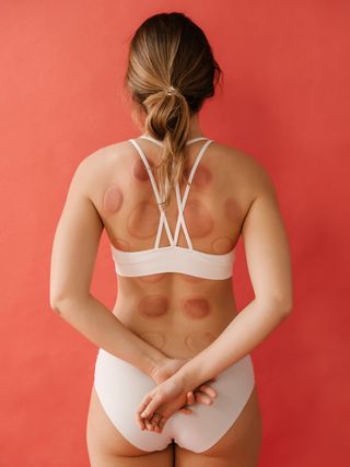 what-is-cupping-therapy-259596-1605232545494-main
