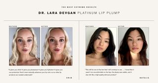 best-lip-plumpers-283524-1661971002465-main
