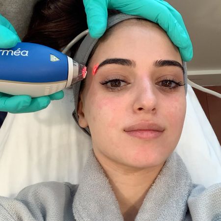 dr-diamond-insta-facial-review-285245-1581641847290-square